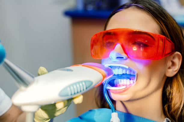 Simplifying Teeth Whitening: A Comprehensive Guide Midlands