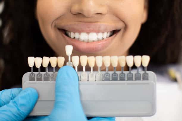 Laser Teeth Whitening: Exploring the Longevity of Your Brighter Smile Midlands