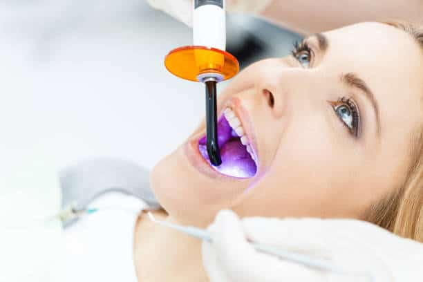 Unveiling the Cost of Laser Teeth Whitening in the UK Midlands