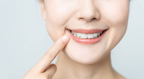 Comparing the Pain Factor: Laser Teeth Whitening vs. Zoom Teeth Whitening Midlands