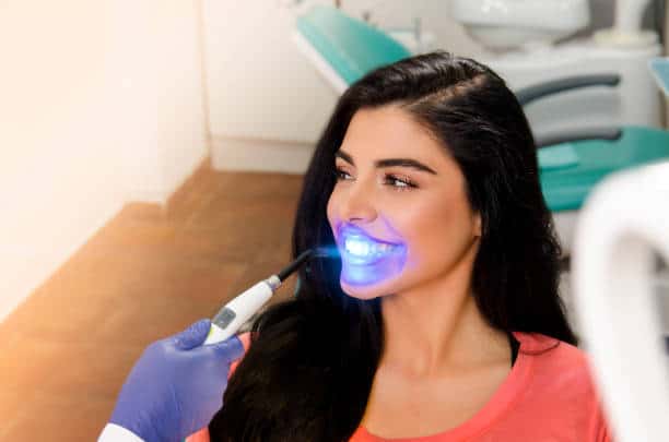 Top Teeth Whitening Systems for a Brighter Smile Midlands