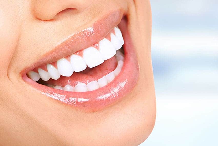 Teeth Whitening Abingdon Midlands